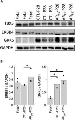 Cardiomyocyte Cell-Cycle Regulation in Neonatal Large Mammals: Single Nucleus RNA-Sequencing Data Analysis via an Artificial-Intelligence–Based Pipeline